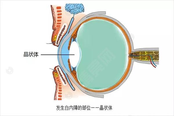 杭州茗视佳眼科