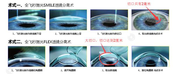 成都市成都青羊保视力眼科诊所收费价格，成都市经济实惠眼科医院。