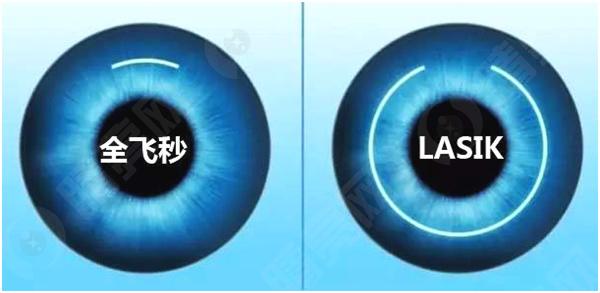 南京蔡司半飞秒近视眼手术哪个医院口碑好？2024南京眼科医院排行榜前五分享