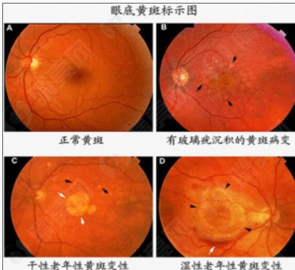 分享杭州柠盟眼科医院眼科项目收费价格 据去过的都说效果好