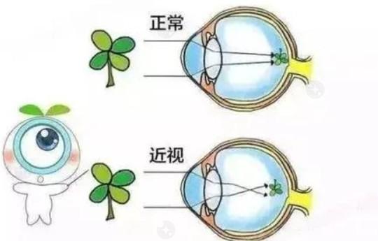 上海眼科医院哪家好?排名前几的这几家口碑好又便宜