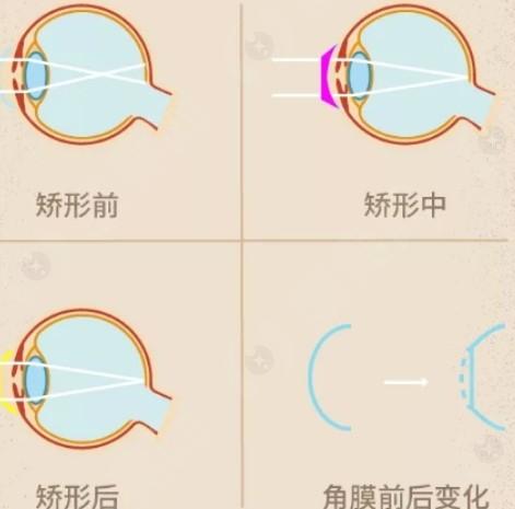 石家庄非球面折叠晶体医院哪个好 这几家是石家庄医院排名靠前的